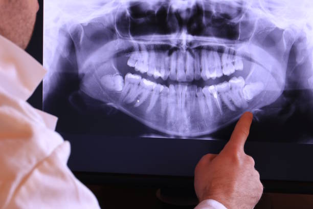Best Mobile Emergency Dentist in Nth Bend, OR